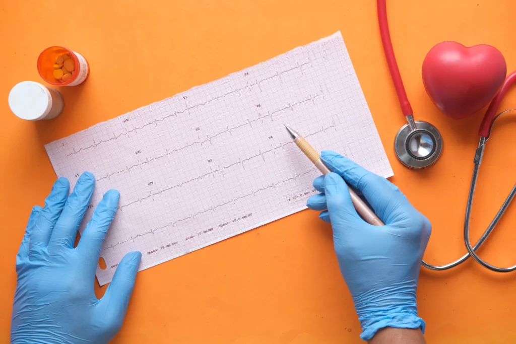 ekg elektrody